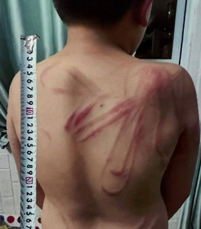 Đà Lạt: Khởi tố bị can vụ bạo hành dã man con trai
