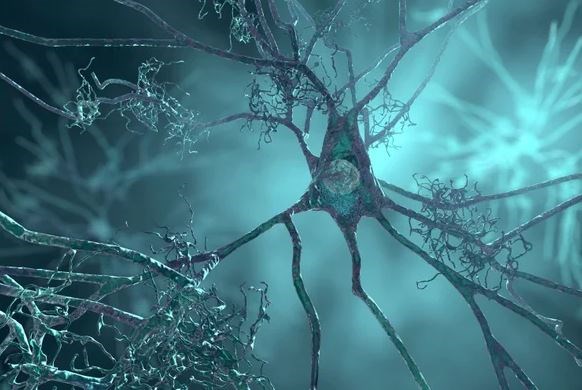 Nhật Bản cấp đánh giá ưu tiên với thuốc lecanemab điều trị Alzheimer