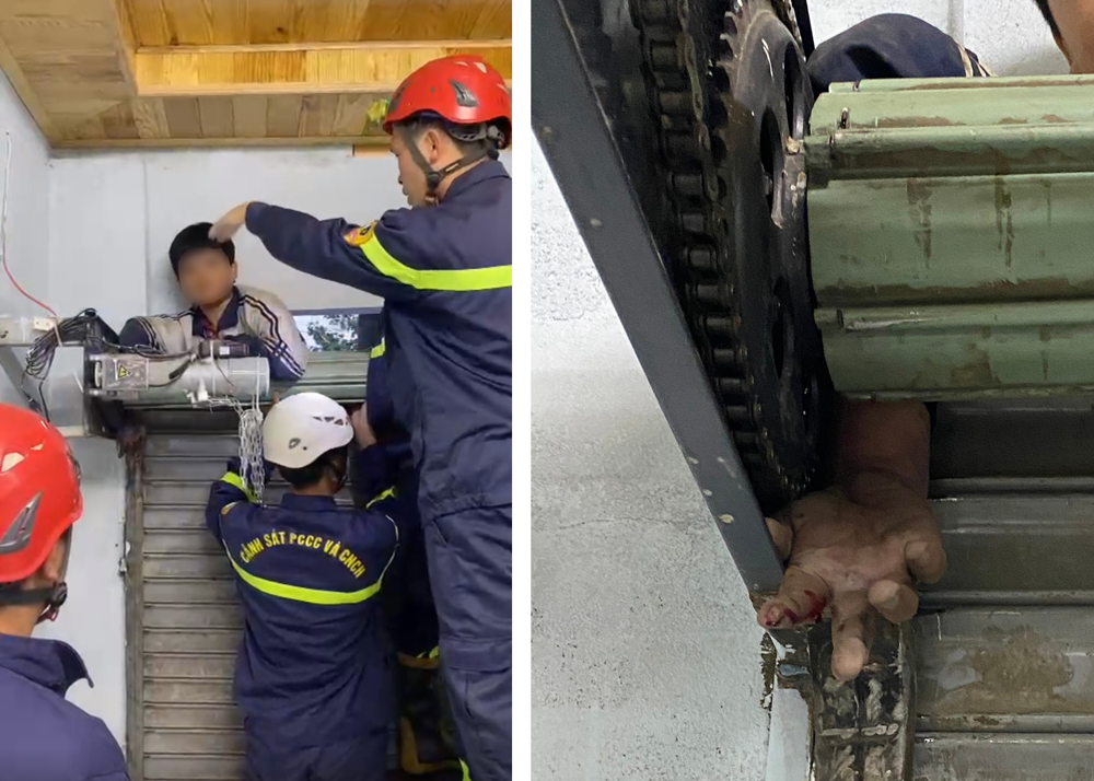 Kịp thời giải cứu cháu bé bị cửa cuốn tay