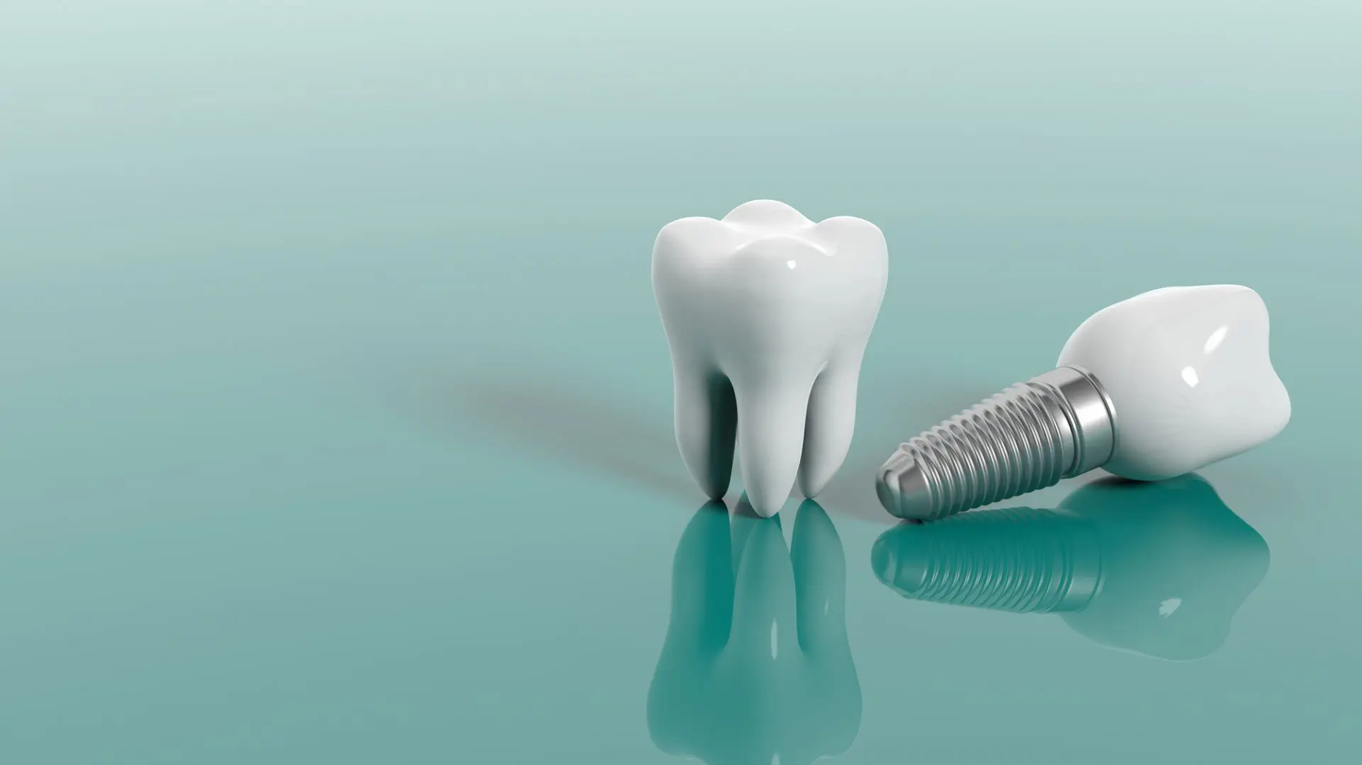 Chi phí cấy ghép Implant giá bao nhiêu? Cách chọn Implant phù hợp túi tiền
