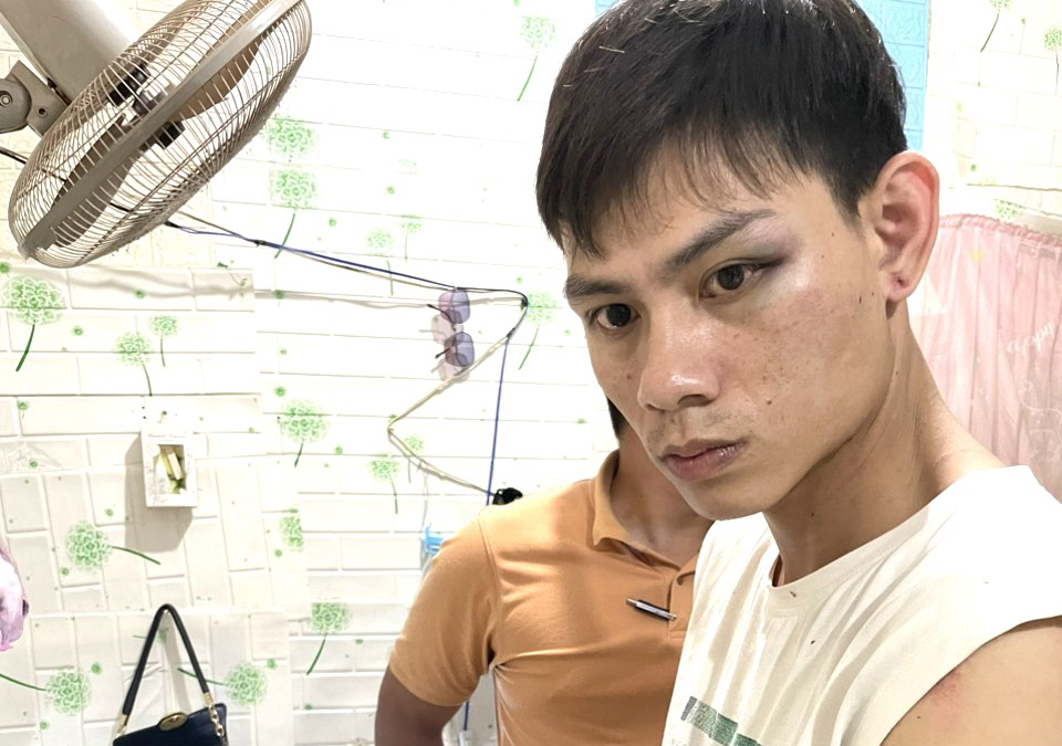 Bảo Lộc: Bắt quả tang đối tượng tàng trữ trái phép chất ma túy