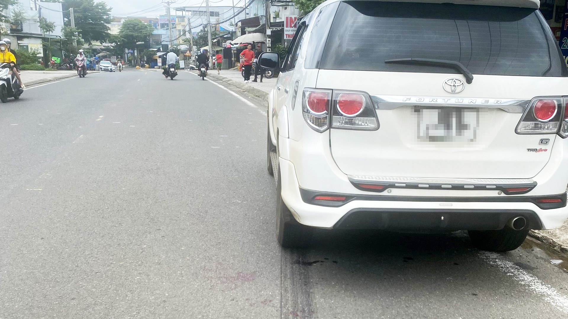 Bảo Lộc: Đi bộ qua đường, bé trai 7 tuổi bị ô tô cán dập nát chân