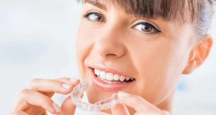 Vì sao niềng răng trong suốt đang chiếm ưu thế hơn so với các loại niềng răng
