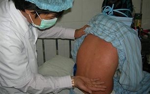 Rubella bùng phát thành dịch tại miền Bắc
