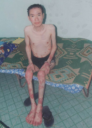 Xin cứu giúp một thanh niên lâm trọng bệnh