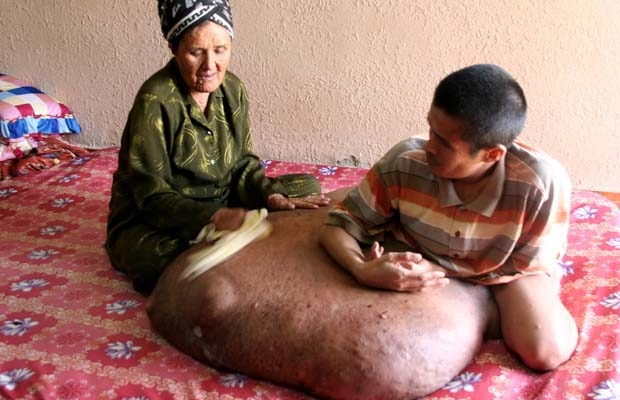 Bà Nguyễn Thị Cho Con đang chăm sóc cho con  