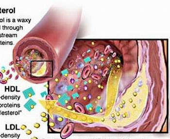 Báo động gia tăng rối loạn lipid máu ở cán bộ, viên chức