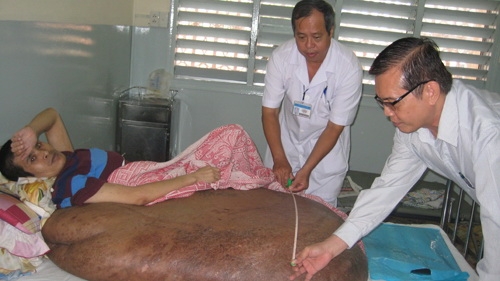 Chúc mừng anh Hải được cắt bỏ khối u 90kg