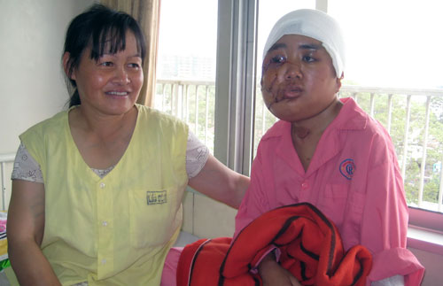 và sau khi được phẫu thuật.