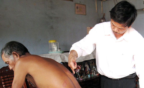 Bảo Lâm nỗ lực loại trừ bệnh phong