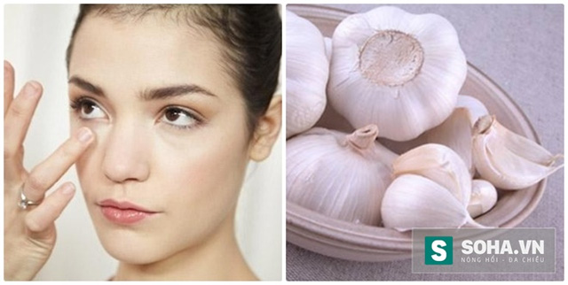 Người có 5 bệnh sau, nhớ đừng ăn tỏi mà mang họa