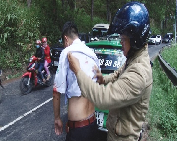Va chạm xe, đâm tài xế taxi trọng thương