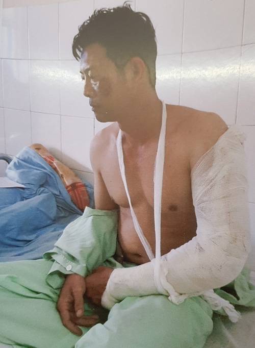 Đà Lạt: Khởi tố chủ quán dùng dao chém chủ nợ