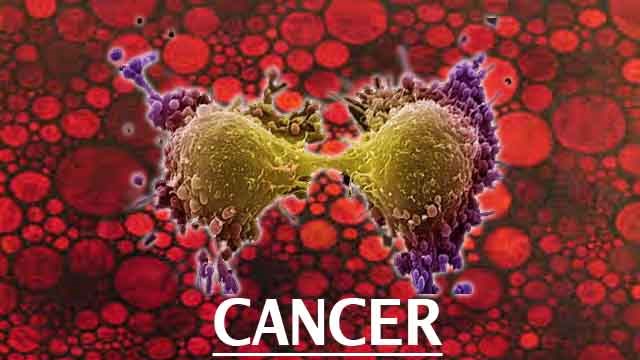 Rượu làm tổn hại chuỗi phân tử DNA, dẫn đến bệnh ung thư