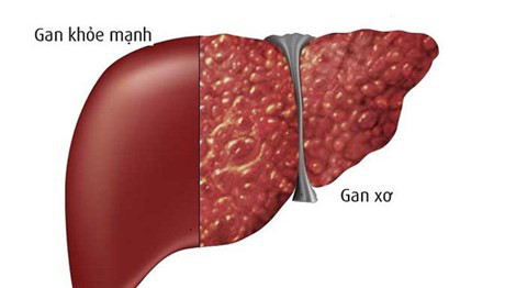 Cảm cúm lúc giao mùa - Những lưu ý khi dùng thuốc