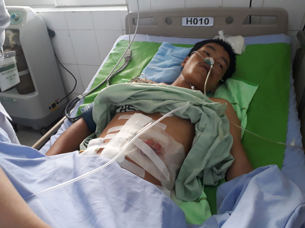 Một thanh niên bị thương nặng vì súng tự chế "cướp cò"