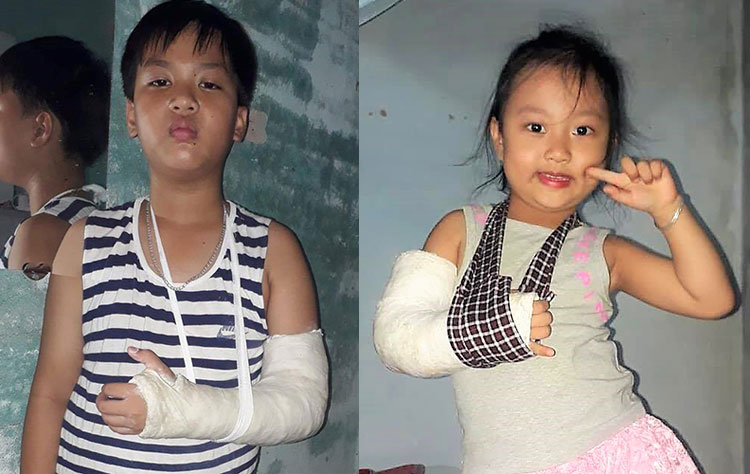 Hai cháu Gia Bảo và Ngọc Anh (con chị Duyên) bị tai nạn gãy tay