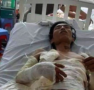 Nam thanh niên bị điện giật nguy kịch cần sự giúp đỡ