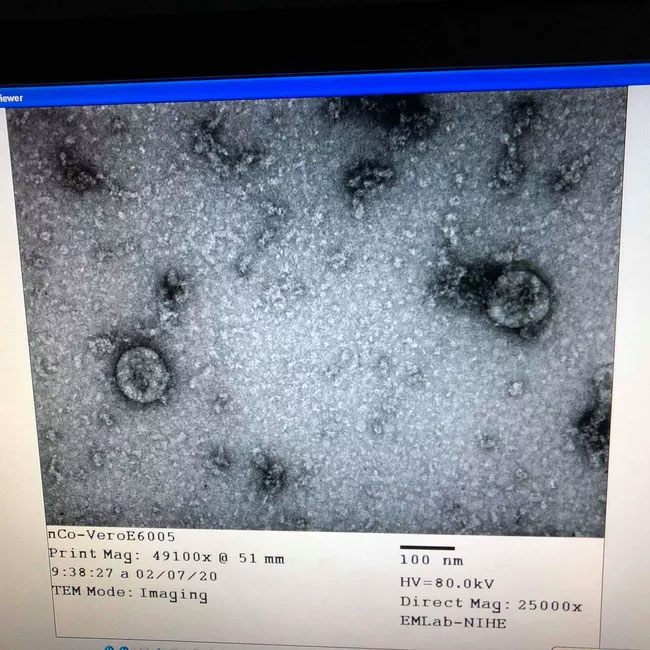 Việt Nam nuôi cấy và phân lập thành công virus Corona mới