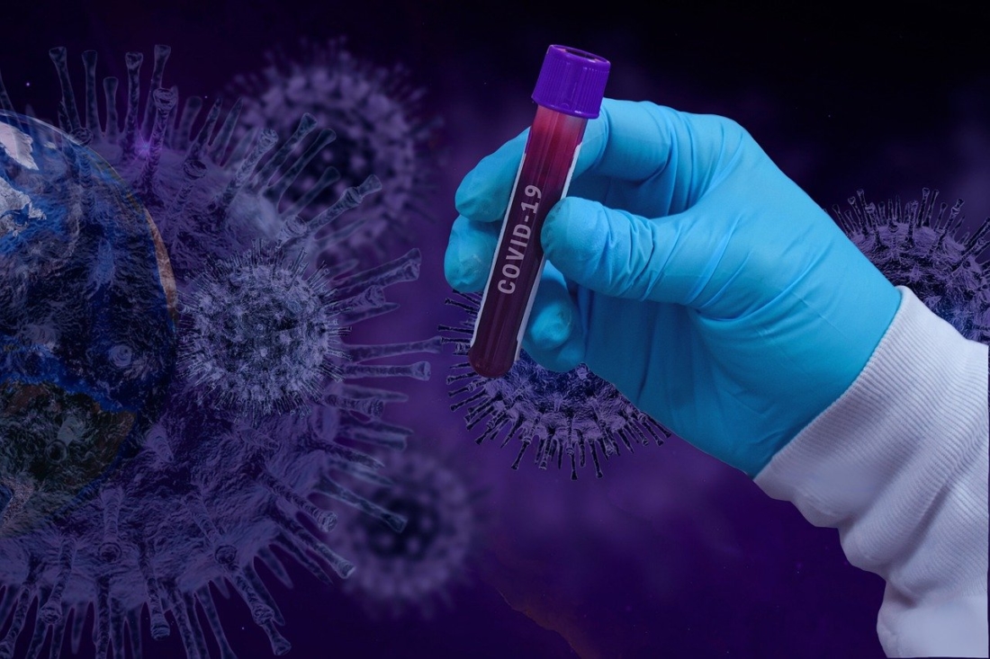 Tình báo Mỹ kết luận virus SARS-CoV-2 không phải 'nhân tạo hay bị biến đổi gien'