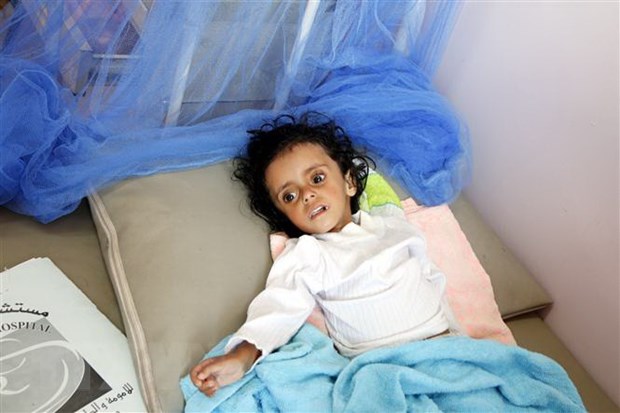 Việt Nam kêu gọi quốc tế chung tay ngăn chặn nạn đói ở Yemen