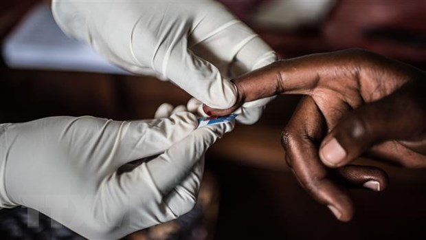 Mỹ phát triển phương pháp "tiêu diệt" HIV tiềm ẩn trong tế bào