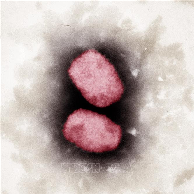 Bỉ giải trình tự gen của virus gây bệnh đậu mùa khỉ