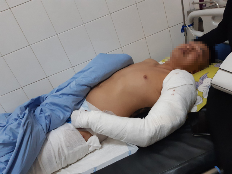 Đà Lạt: Truy tìm đối tượng cầm đầu nhóm côn đồ chém người