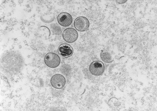 Chủng virus đậu mùa khỉ ở Ấn Độ khác với chủng ở châu Âu